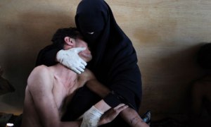 Samuel Arandas award-winning photograph of a Yemeni mother cradling her injured son